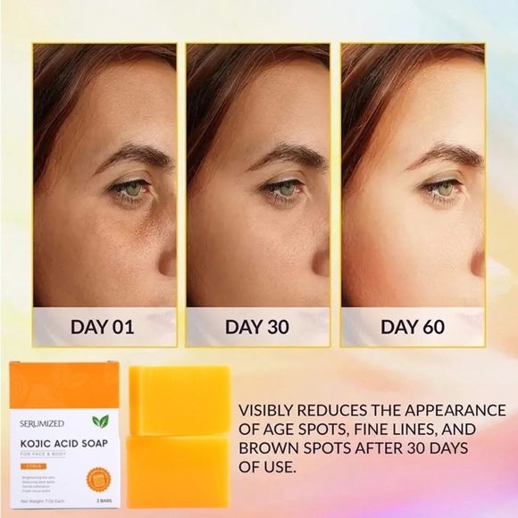 𝓢𝓮𝓻𝓾𝓶𝓲𝔃𝓮𝓭®️Dark Spot Remover Soap Bars - Picture 4 of 13